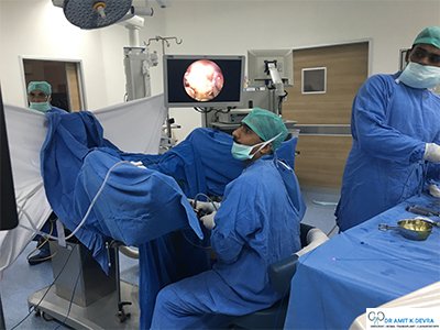 Endoscopic and Laser Prostate Surgery
