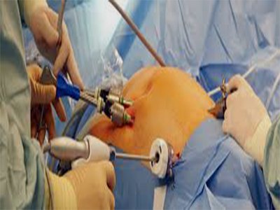 Laparoscopic Urology