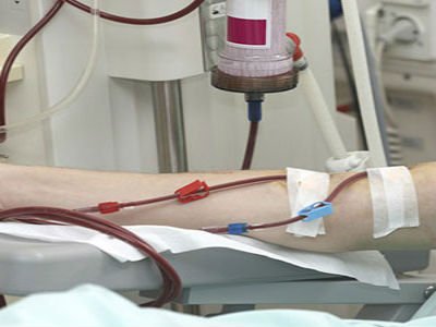 Dialysis Access Procedures