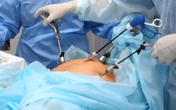 Best Laparoscopic Treatment in Sector 77, Noida