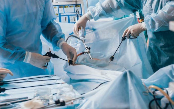 Top Laparoscopic Surgery in Sector 76, Noida