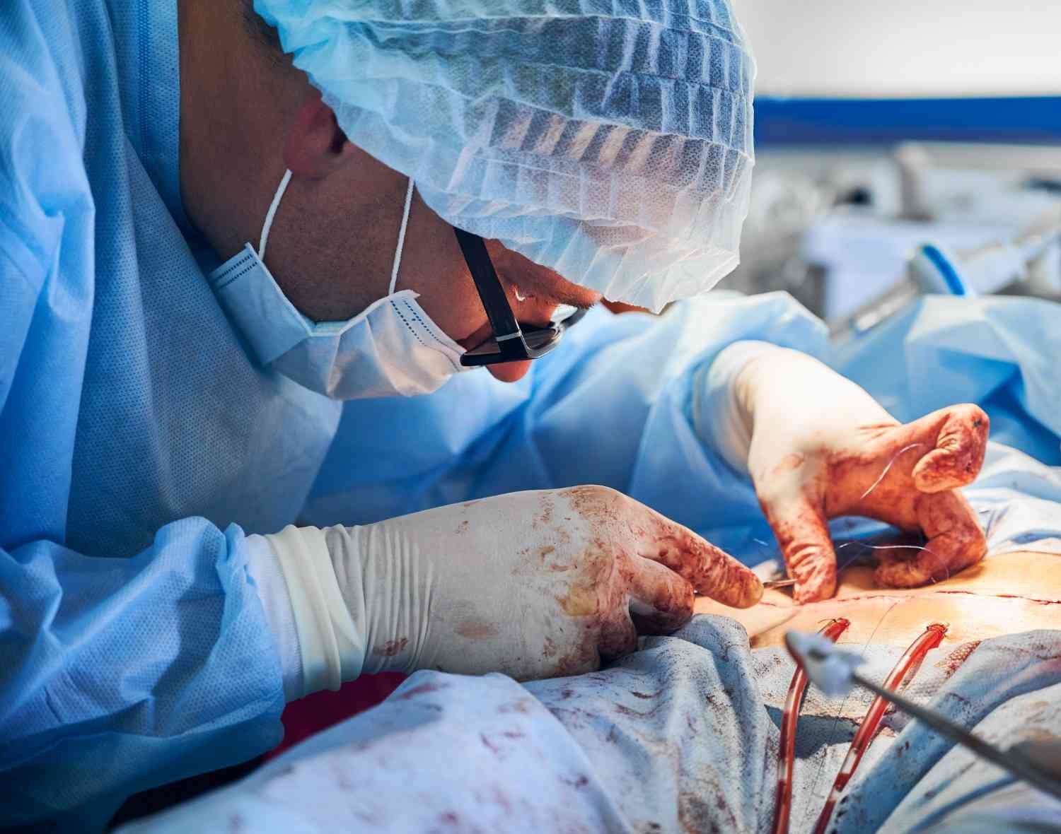 Head Kidney Transplant Surgery in Noida Extension