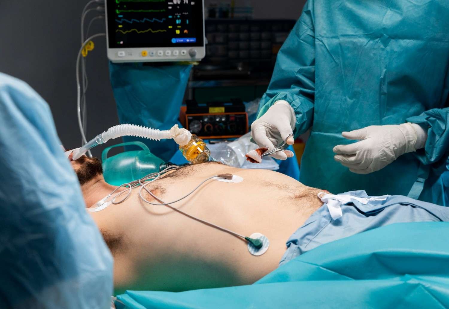Endoscopic Kidney Stone Surgery in Noida