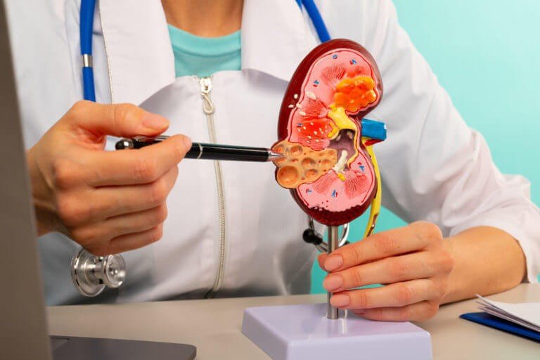 Best Kidney Stone Doctor in Noida