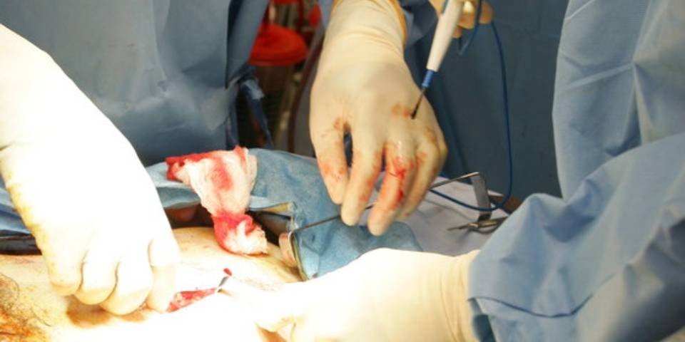 Prostate Surgeon in Noida Extension